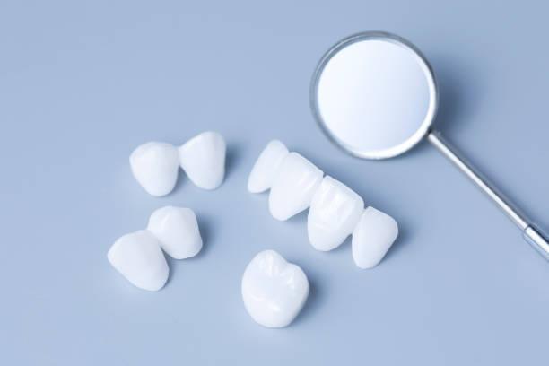 porcelain veneers with a dental mirror