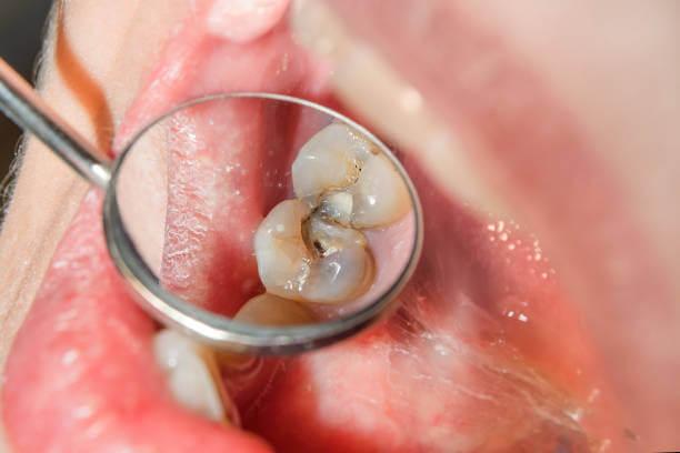 a close-up of a person's mouth with a magnifying glass