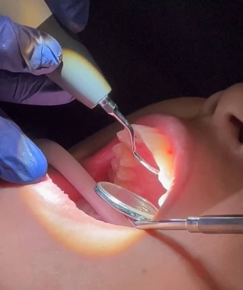 Cosmetic Dentistry Kew Gardens Hills