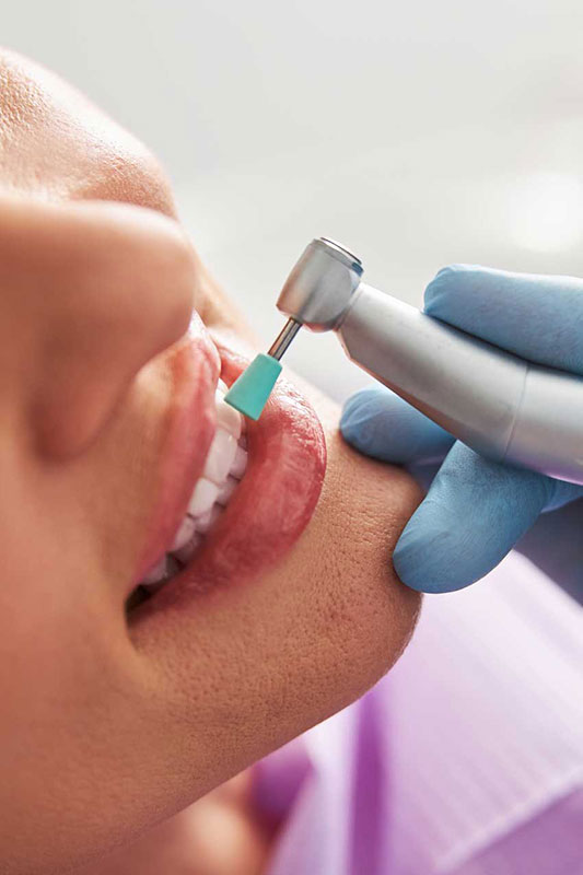 Teeth Cleaning Auburndale